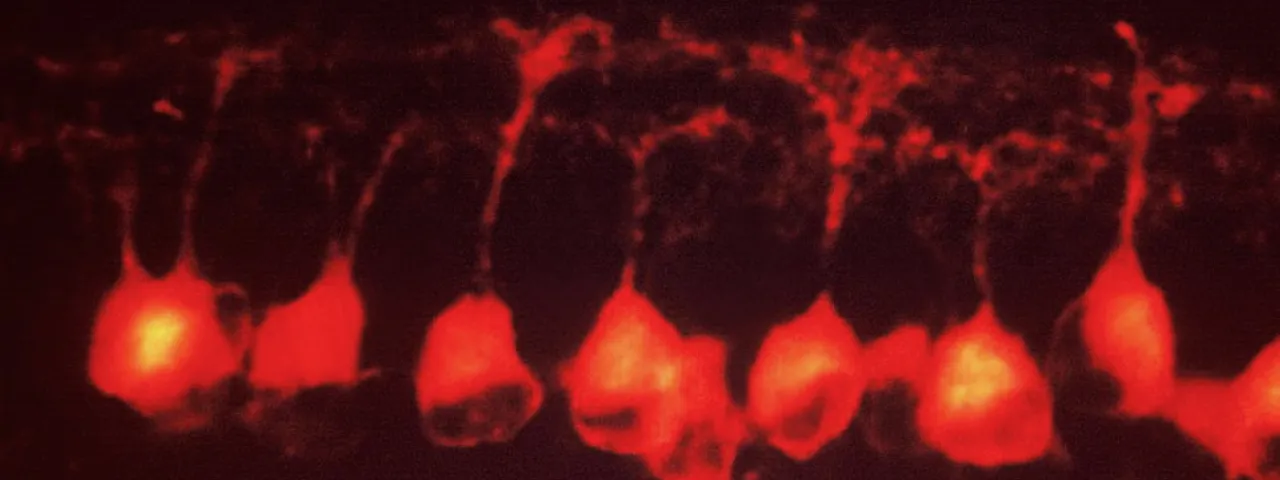 Image of retinal ganglion cells